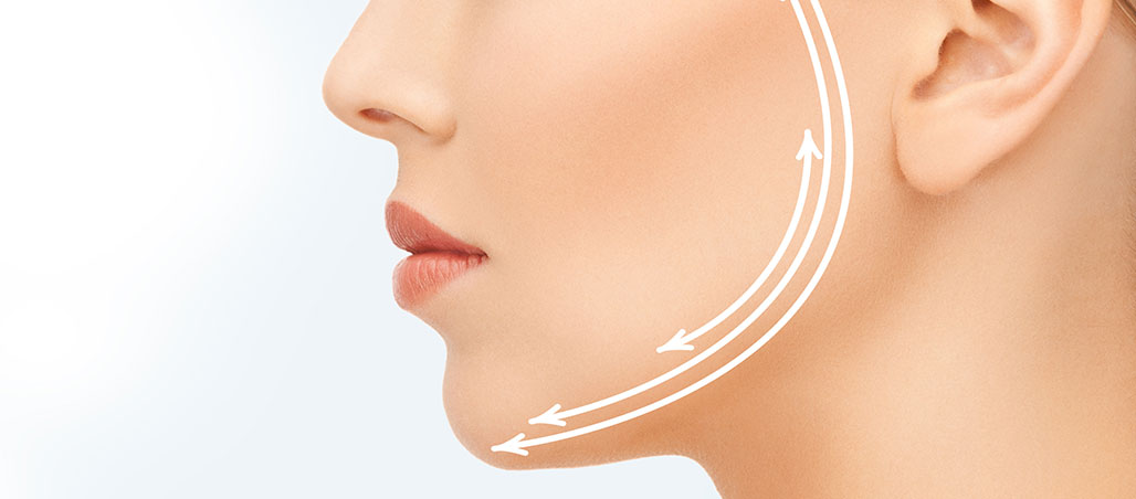 Mitras Estética - Preenchimento Facial Contorno Mandibular